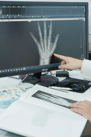 兒科特別門診可以透過X光可以看到手指、手掌、手腕的生長板,藉此了解兒童的成長狀態。(圖/官方提供) ▲兒科特別門診可以透過X光可以看到手指、手掌、手腕的生長板,藉此了解兒童的成長狀態。(圖/官方提供)