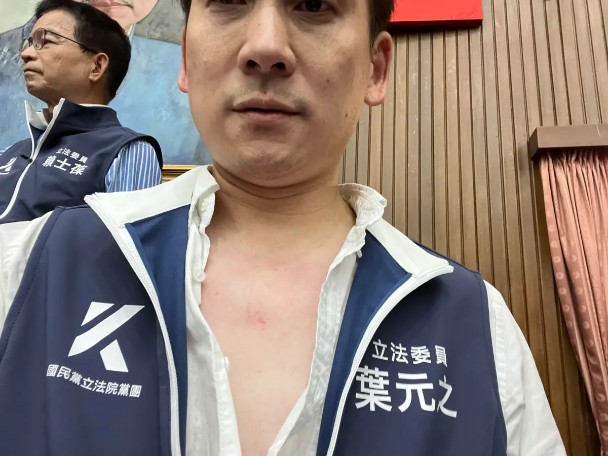 ▲立委葉元之貼出掛彩照。（圖／翻攝葉元之臉書）