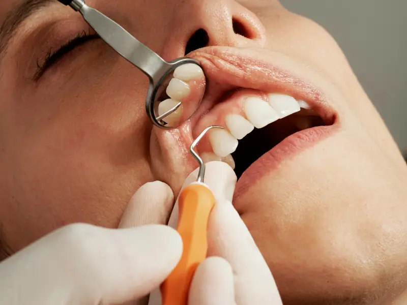 ▲口臭未必是體內火氣大，牙醫師指出，8至9成的口臭源頭是口腔與鼻腔。（示意圖，非當事人／取自Unsplash）
