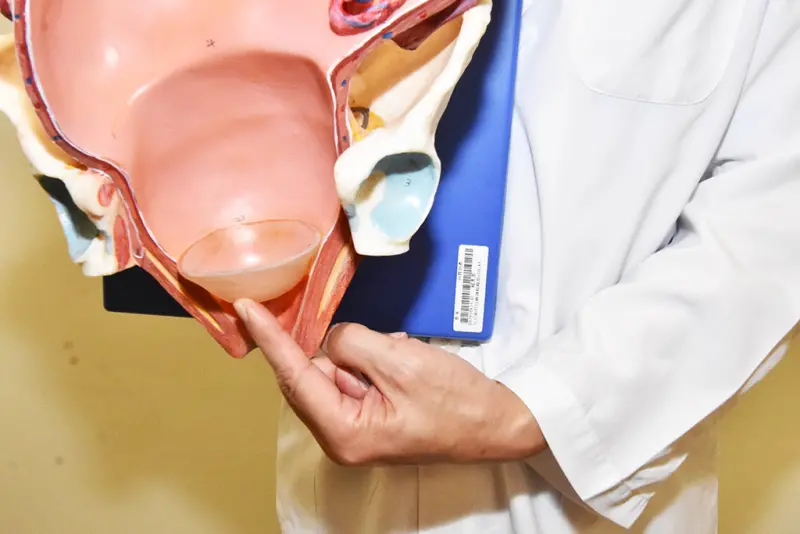 ▲女性骨盆底肌肉（手指處）產後會受傷，長時間使力恐造成子宮等器官脫垂。（圖／彰基提供）