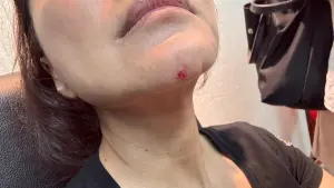 林楚茵 ▲林楚茵下巴見血將赴醫院驗傷。(圖/林楚茵辦公室提供)