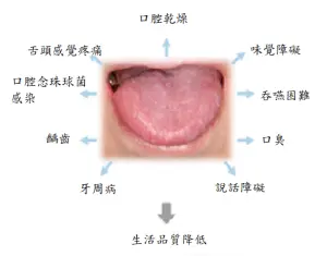 ▲嚴重口乾可能引起很多健康問題。（圖／北市聯醫提供）