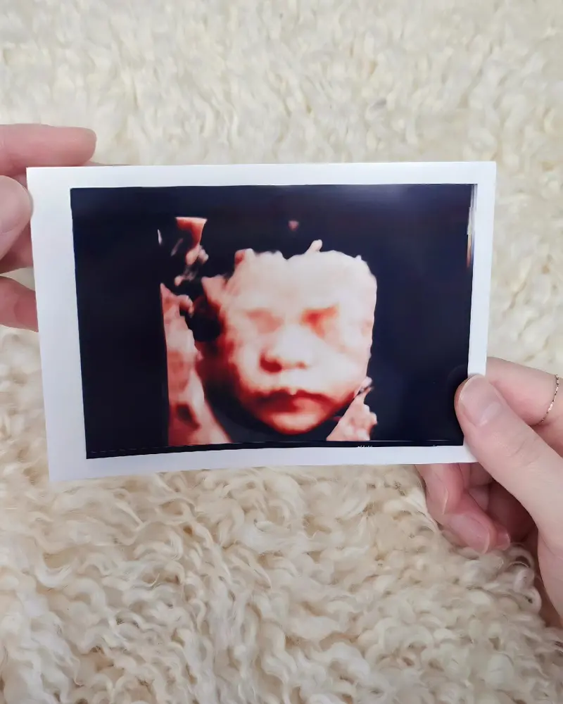 ▲晟敏開心展示骨肉的超音波照片,結婚10多年、38歲的他終於得娃。(圖/晟敏IG)