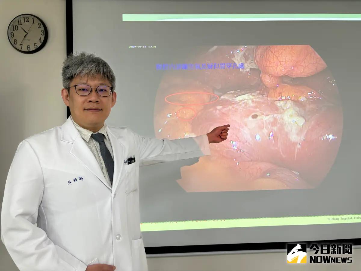 ▲台中醫院消化外科醫師徐天佑呼籲，長期吃止痛藥當心副作用造成胃潰痬。（圖／記者金武鳳攝，2024.7.19)