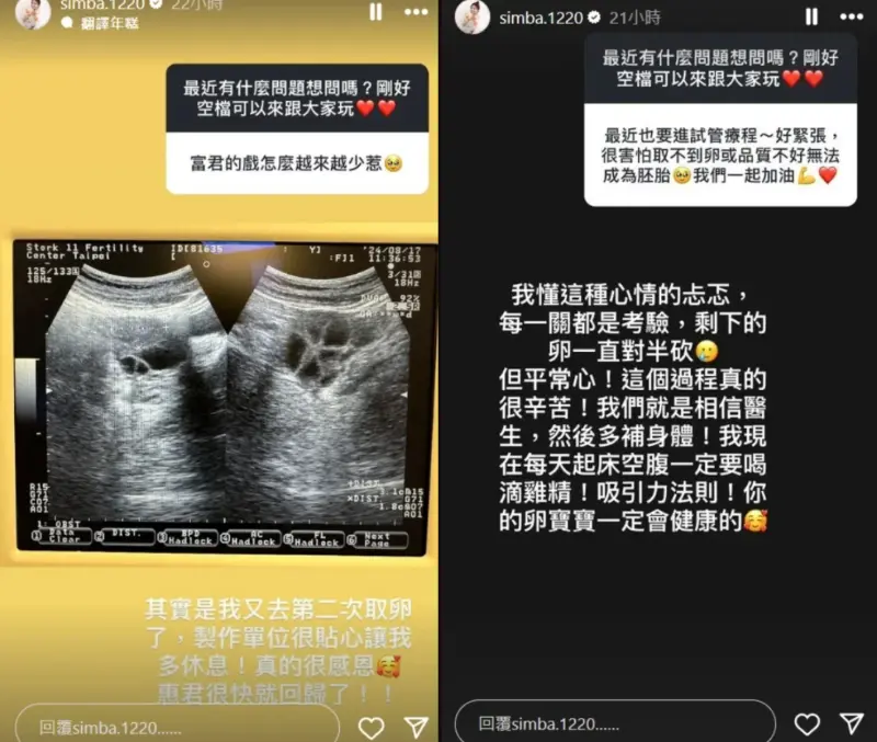▲曾智希說自己到醫院取卵，因為休息關係戲份才減少；她同時也安慰其他試管媽媽要照顧好身體。（圖／曾智希IG）