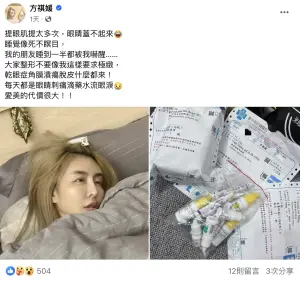 ▲雪碧近日飽受整形手術後遺症困擾，透露現在眼睛無法正常閉合，連友人也被自己睡覺的模樣嚇傻。（圖／雪碧臉書）