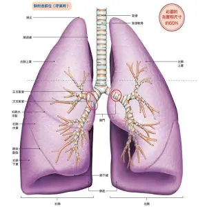 ▲腫瘤長在肺門的中央型肺癌，透過自體肺移植療法，比傳統外科手術更能保留患者肺功能。（圖／大是文化提供）