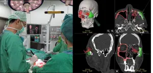 ▲馬偕醫院口腔顎面外科透過3D列印、導航技術，將李先生錯位骨塊復位至理想角度。（圖／馬偕醫院提供）