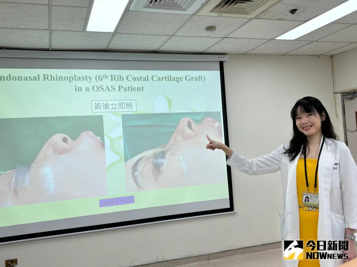 ▲人妻長年受困打鼾、呼吸中止，台中醫院耳鼻喉科主任季照芸說明治療方案。（圖／記者金武鳳攝，2024.9.20)