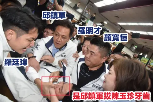 影/被徐巧芯控「弄斷牙元凶」 賴惠員PO圖反擊:是邱鎮軍拔斷!