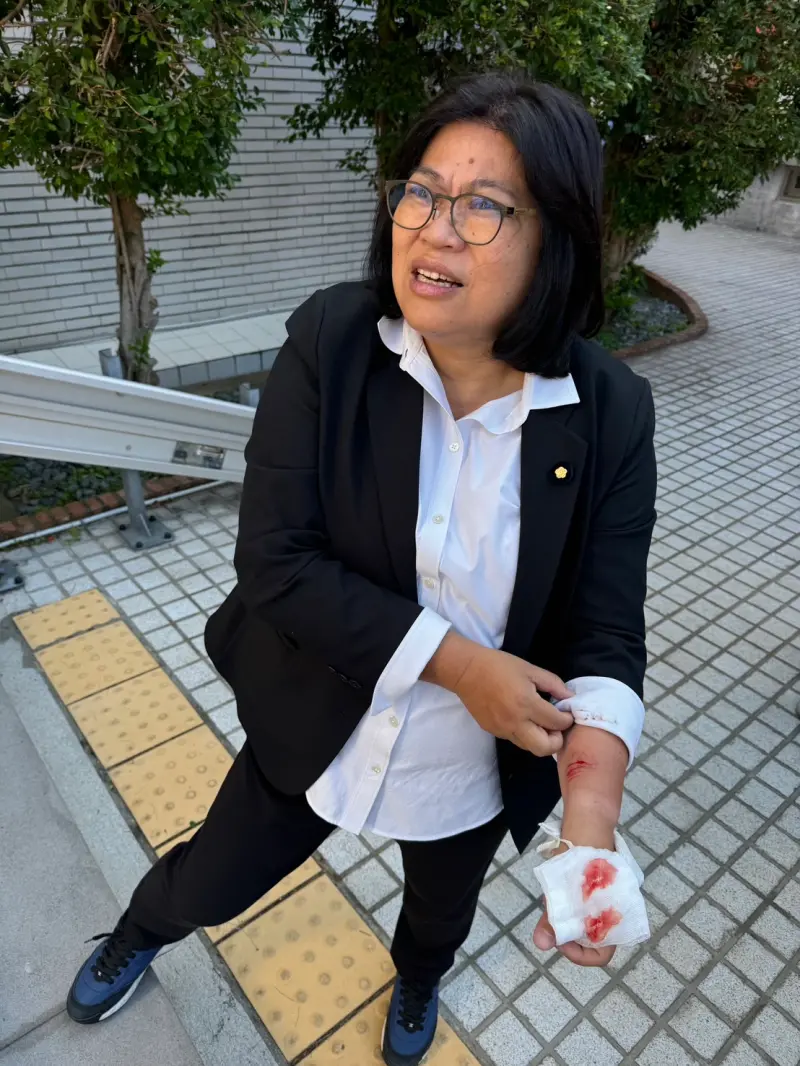 ▲王美惠昨在立院阻擋國民黨欲修法提高罷免門檻負傷濺血。(圖/王美惠辦公室提供)