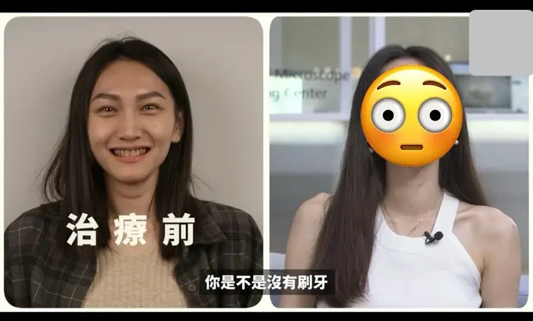 ▲網友在PTT貼出一名妙齡女子牙齒治療前後的對比照，引起廣大討論。（圖／翻攝自PTT）