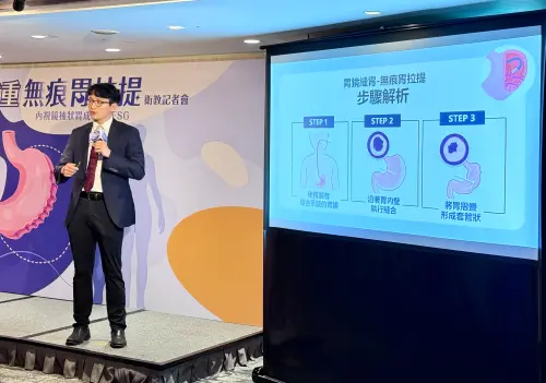 周莒光主任表示,「無痕胃拉提」手術是由口腔進入的內視鏡手術,可縮小胃部容量70%達到減重效果,具有恢復期短、手術風險低、無體表傷等優勢。(圖/記者周淑萍攝) ▲周莒光主任表示,「無痕胃拉提」手術是由口腔進入的內視鏡手術,可縮小胃部容量70%達到減重效果,具有恢復期短、手術風險低、無體表傷等優勢。(圖/記者周淑萍攝)
