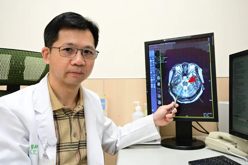 ▲患者腦部MRI影像出現腦幹異常萎縮與獨特的「熱十字麵包徵候」異象，研判是「多發性系統萎縮症」惹禍(圖／醫院提供2024.12.19)