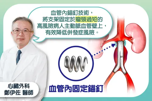 肚子「跳動性腫塊」不理！男腹主動脈瘤破裂瀕死　血管內錨釘急救
