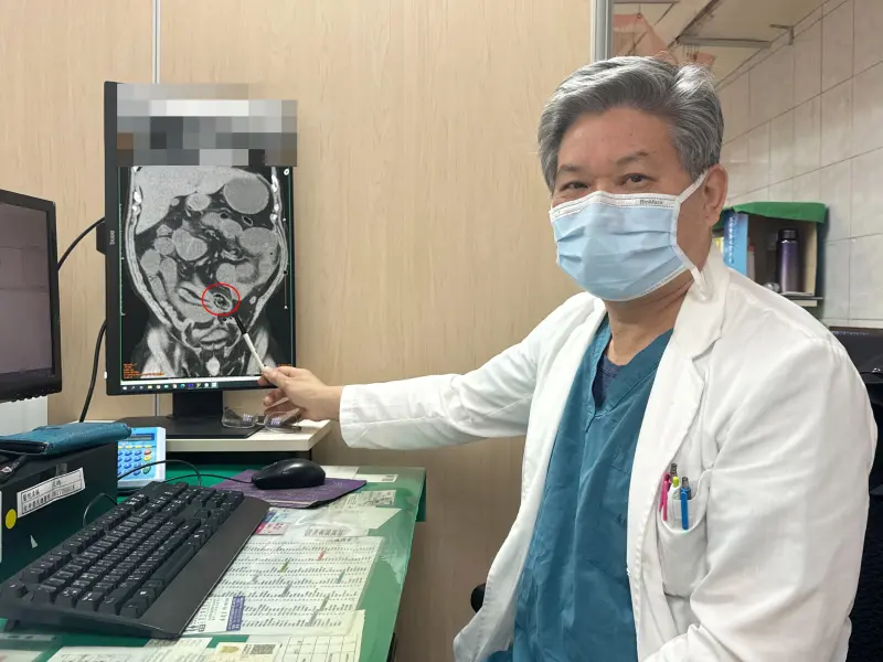 ▲李綜合醫院外科醫師許明賢指出，患者吃香菇沒咬碎造成腸阻塞(圖／醫院提供2025.1.14)