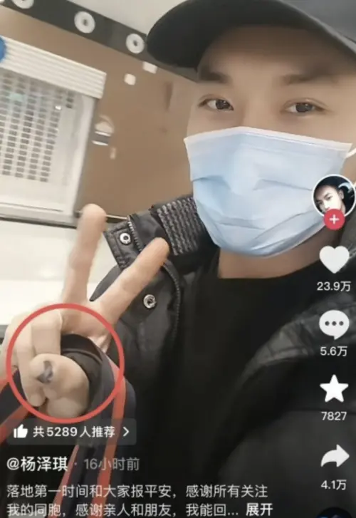 ▲楊澤琪獲救時手指指甲明顯發黑，疑似在園區內遭到虐待。（圖／楊澤琪抖音）