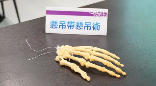 ▲新一代懸吊帶懸吊術大幅縮短手術時間，術後恢復較快，同時保有傳統手術的穩定性及療效。（圖／奇美醫院提供）