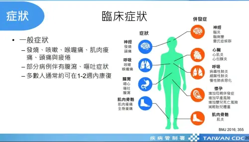 ▲流感臨床症狀一覽。（圖／疾管署提供）