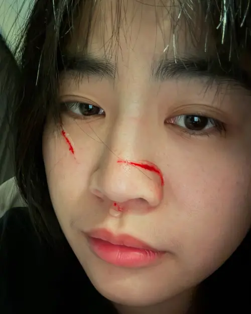 ▲陳伊睡覺途中被愛貓偷襲,讓她的臉上多出2道鮮紅的傷痕。(圖/翻攝自陳伊 IG) ▲陳伊睡覺途中被愛貓偷襲,讓她的臉上多出2道鮮紅的傷痕。(圖/翻攝自陳伊 IG)