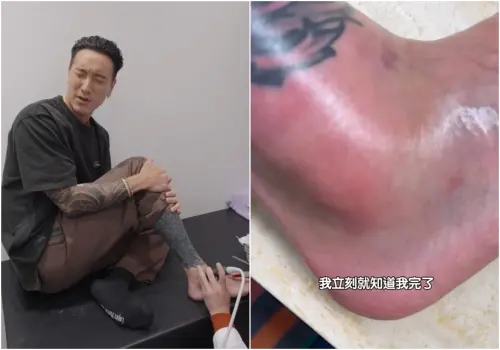 ▲王陽明在澳洲出事了！韌帶撕裂、2處骨裂　急返台治療傷勢曝光（圖／王陽明IG）