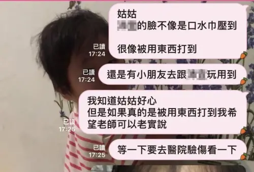 ▲台南一名母親送1歲的女兒去補習班，沒想到接女兒回家時看到臉上有大片抓痕及瘀青，業者聲稱是遭口水巾壓到所致，甚至還打電話要求這名母親「不要驗傷，否則會完蛋」。（圖／翻攝臉書）