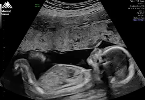 ▲廣告小妹4年前懷孕時,不慎流產,讓她難過喊道:「是不是我哪個環節做錯了?」(圖/廣告小妹 臉書) ▲廣告小妹4年前懷孕時,不慎流產,讓她難過喊道:「是不是我哪個環節做錯了?」(圖/廣告小妹 臉書)