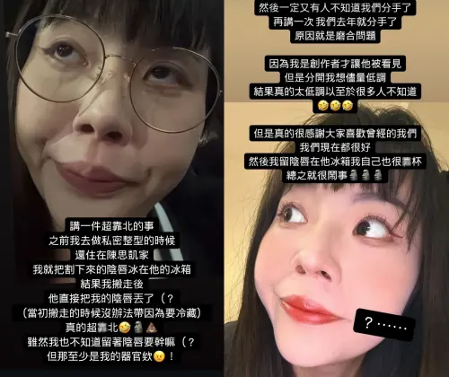 ▲超直白說話很直接,把醫美私事通通說出來。(圖/超直白IG) ▲超直白說話很直接,把醫美私事通通說出來。(圖/超直白IG)