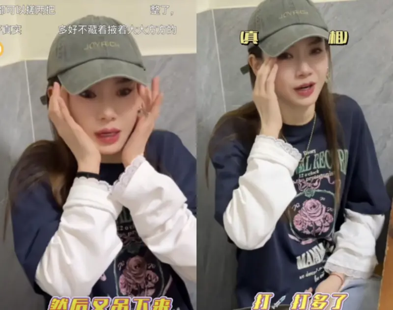 ▲戚薇坦承肉毒打太多。（圖／翻攝自微博）