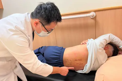 從2層樓高摔下！男子脊椎爆裂複雜性骨折　新型微創手術隔天下床
