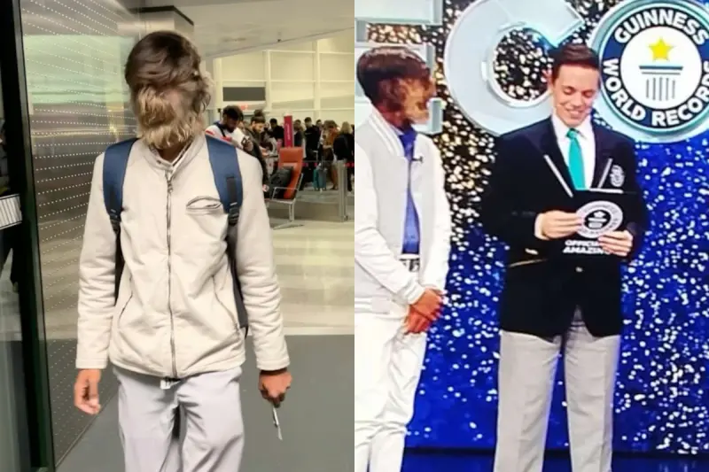 ▲一名18歲少年帕蒂達爾日前獲金氏世界紀錄認證為「臉部毛髮最濃密的男性」。（圖／翻攝自臉書）