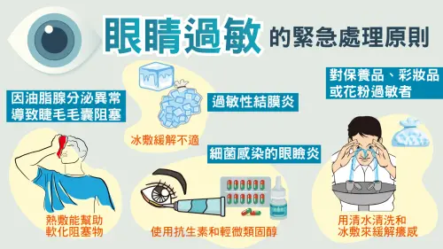 ▲許粹剛整理眼睛過敏護理方式。(圖/振興醫院提供) ▲許粹剛整理眼睛過敏護理方式。(圖/振興醫院提供)