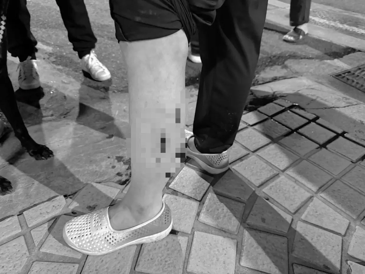 ▲3月初發生比特犬傷人事件後，日前新北市一名女子也遭友人飼養的狗咬傷，雖然受傷女子對飼主提告「過失傷害」，但是在台灣，養狗傷人幾乎不需負擔刑事責任，相較國外罰則較輕。（圖／警方提供）