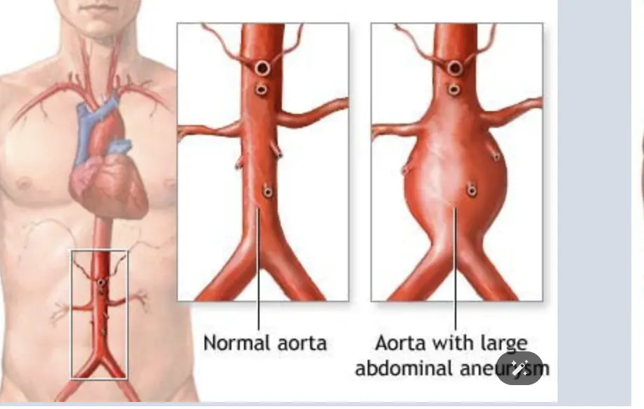 ▲三軍總醫院指出，主動脈剝離約9成人會出現胸痛。（圖/翻攝自三軍總醫院官網）