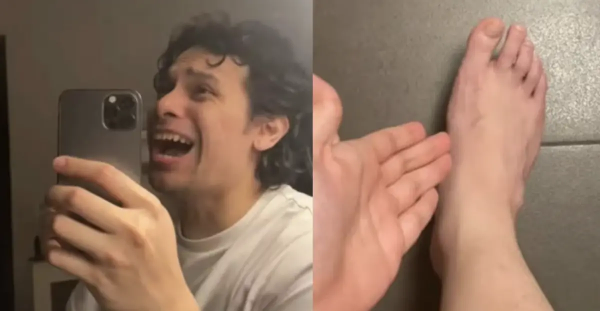 ▲一名28歲男子為了健美體態而狂吃紅肉而且很少喝水，沒想到竟然得痛風。（圖／翻攝自TikTok）