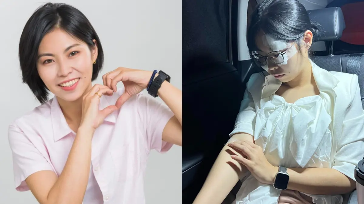 ▲陳芳盈遭遇嚴重車禍，目前左眼幾近全盲狀態。（圖／翻攝自陳芳盈臉書）