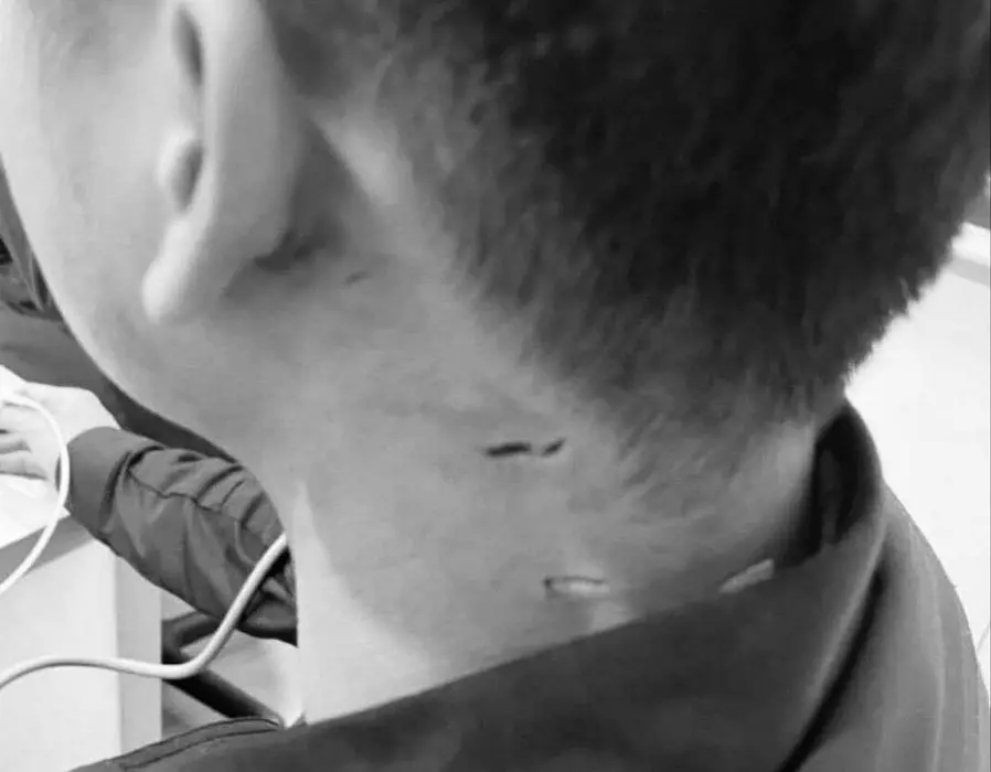 ▲台北警察專科學校發生砍人事件！遭砍的同學緊急被送醫，傷口縫了三針。（圖／翻攝記者爆料網）