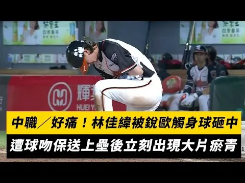 中職／好痛！林佳緯被銳歐觸身球砸中　遭球吻保送上壘後立刻出現大片瘀青｜NOWnews