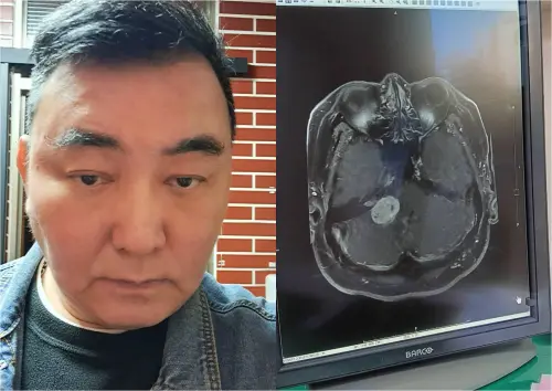 ▲徐亨暈倒診斷出腦瘤！宣布離婚「淨身出戶」獨扛2億債務現況曝光（圖／徐亨臉書）