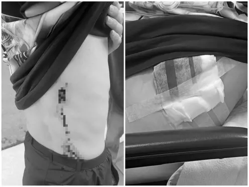 韓留學生西門町遭隨機砍傷　蔣萬安震怒：指示加強巡邏與路檢
