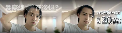 ▲開始禿頭後才思考解決之道的想法早已過時，預防勝於治療才是正確新觀念