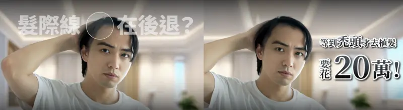 ▲開始禿頭後才思考解決之道的想法早已過時,預防勝於治療才是正確新觀念(圖/萌髮科研提供)