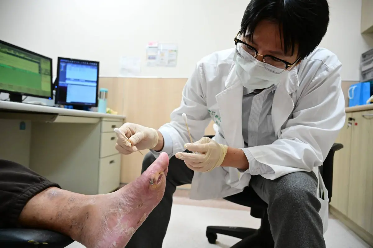 ▲醫師為清創後的糖尿病足潰瘍患者換藥，總算免於面臨截肢之苦。(圖／醫院提供2025.4.15)