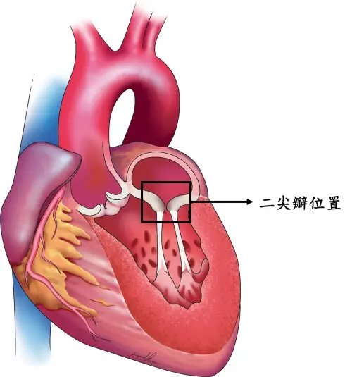 ▲二尖瓣位置示意圖。(圖/長庚醫院提供) ▲二尖瓣位置示意圖。(圖/長庚醫院提供)