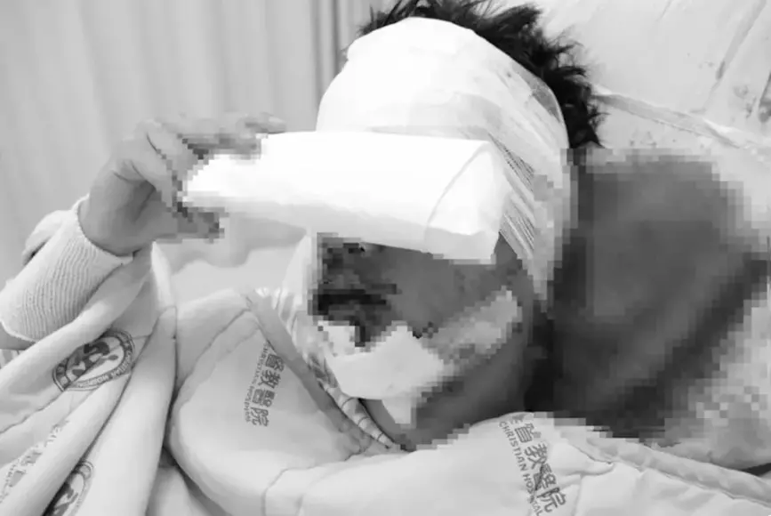 ▲康橋單車成年禮遇上車子逆向撞擊學生自行車隊，造成7名學生受傷送醫，其中顏姓男學生傷勢嚴重被轉送彰基醫院搶救。（圖／彰化醫院提供）