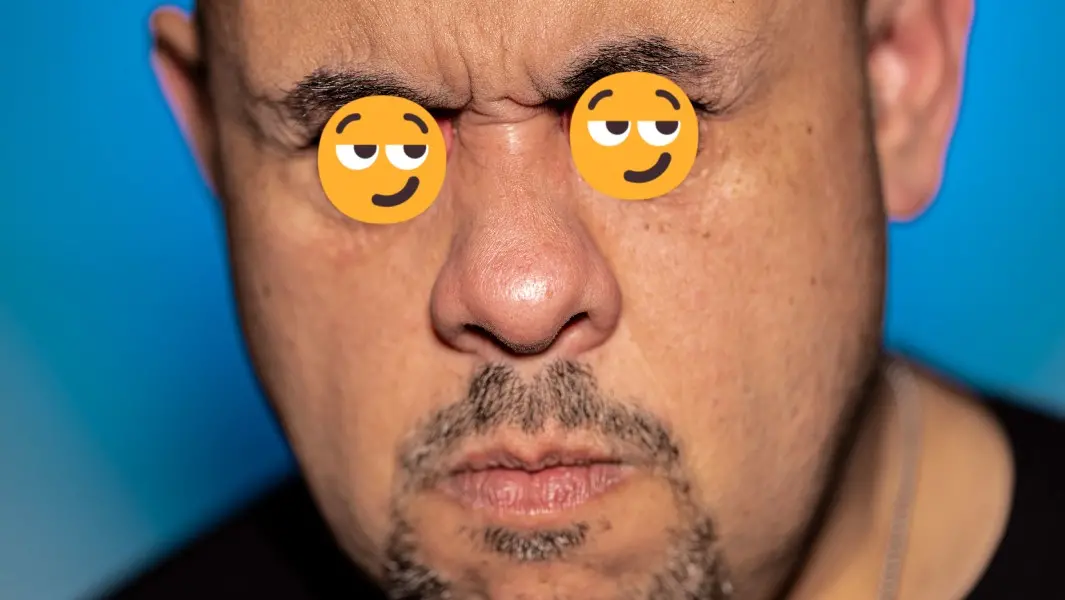 ▲一名現居義大利的烏拉圭男子洛佩斯（Williams Martin Sanchez Lopez）因眼球突出距離達到驚人的19毫米，刷新金氏世界紀錄。（圖／GuinnessWorldRecords官網）