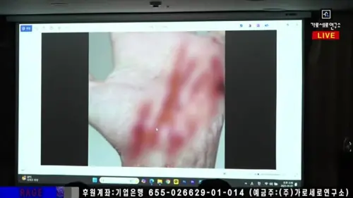 ▲舉報人持有金賽綸生前錄音檔而受到生命威脅，還被2名歹徒在頸部刺了足足9刀。（圖／橫豎研究所）