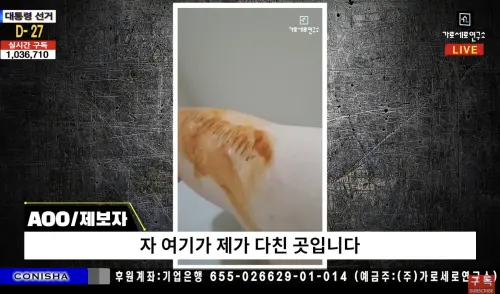 ▲證人拍影片自證傷勢，並無奈表示雖然先前已經拍了傷勢照，「但怕又有什麼鬼話，所以拍攝影片，真是謝囉」。（圖／橫豎研究所）