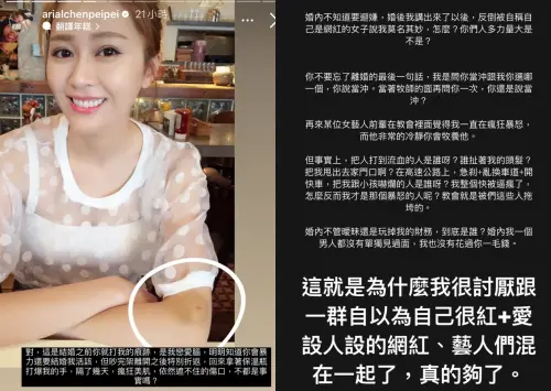 ▲陳佩佩在社群平台PO出1772字的血淚控訴，拿鐵在婚前婚後都曾行為失當，在家裡對她家暴，對外卻塑造好男人形象。（圖／陳佩佩IG）