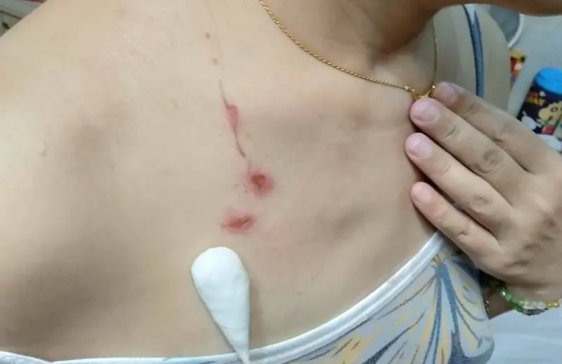 吹風機突冒火！台中女客胸前灼傷求償　只收到墾丁福容XO醬